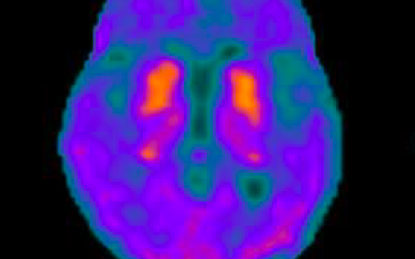Pacific Radiology makes strides into neurodegenerative research