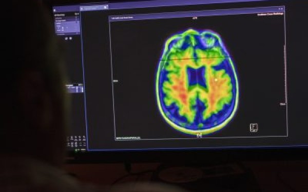 Tackling concussion risks in Junior Rugby