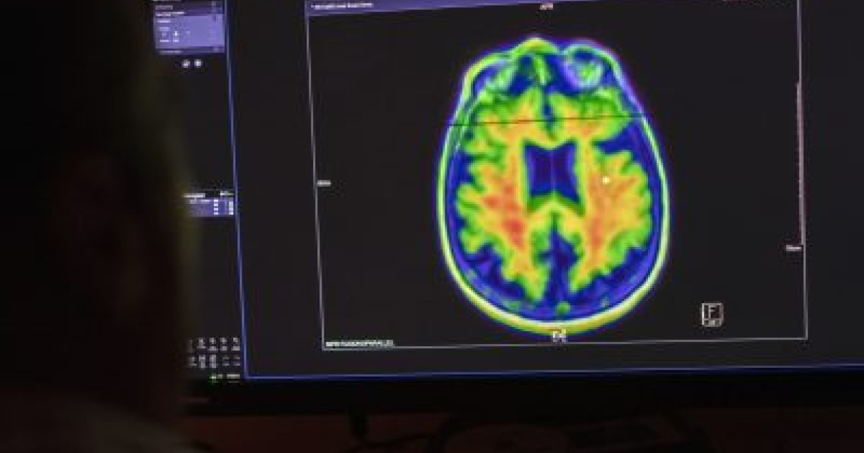 Tackling concussion risks in junior rugby