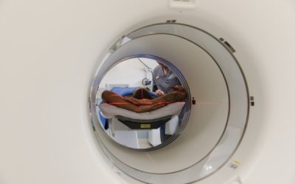 Treatable & Beatable - Bowel Cancer