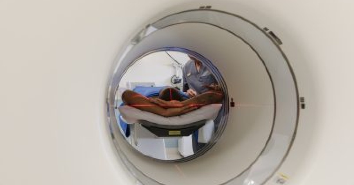 Treatable and Beatable   Bowel Cancer